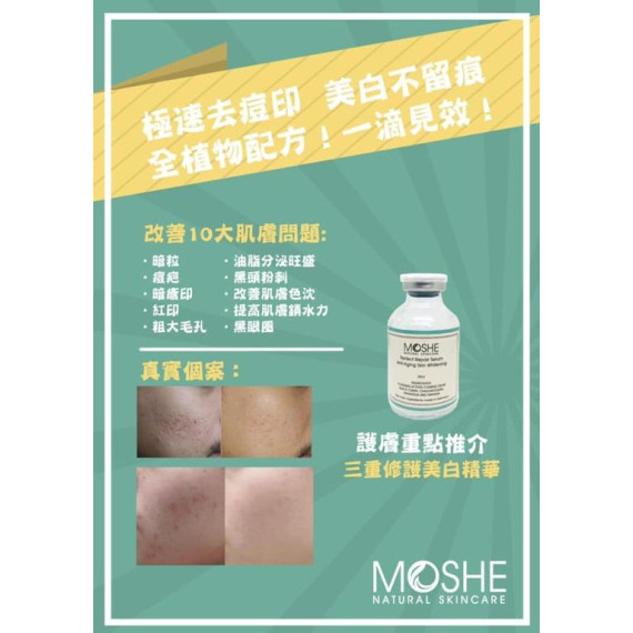 Moshe Perfect Repair Serum Anti-Aging Skin Whitening 升級版三重美白精華 
